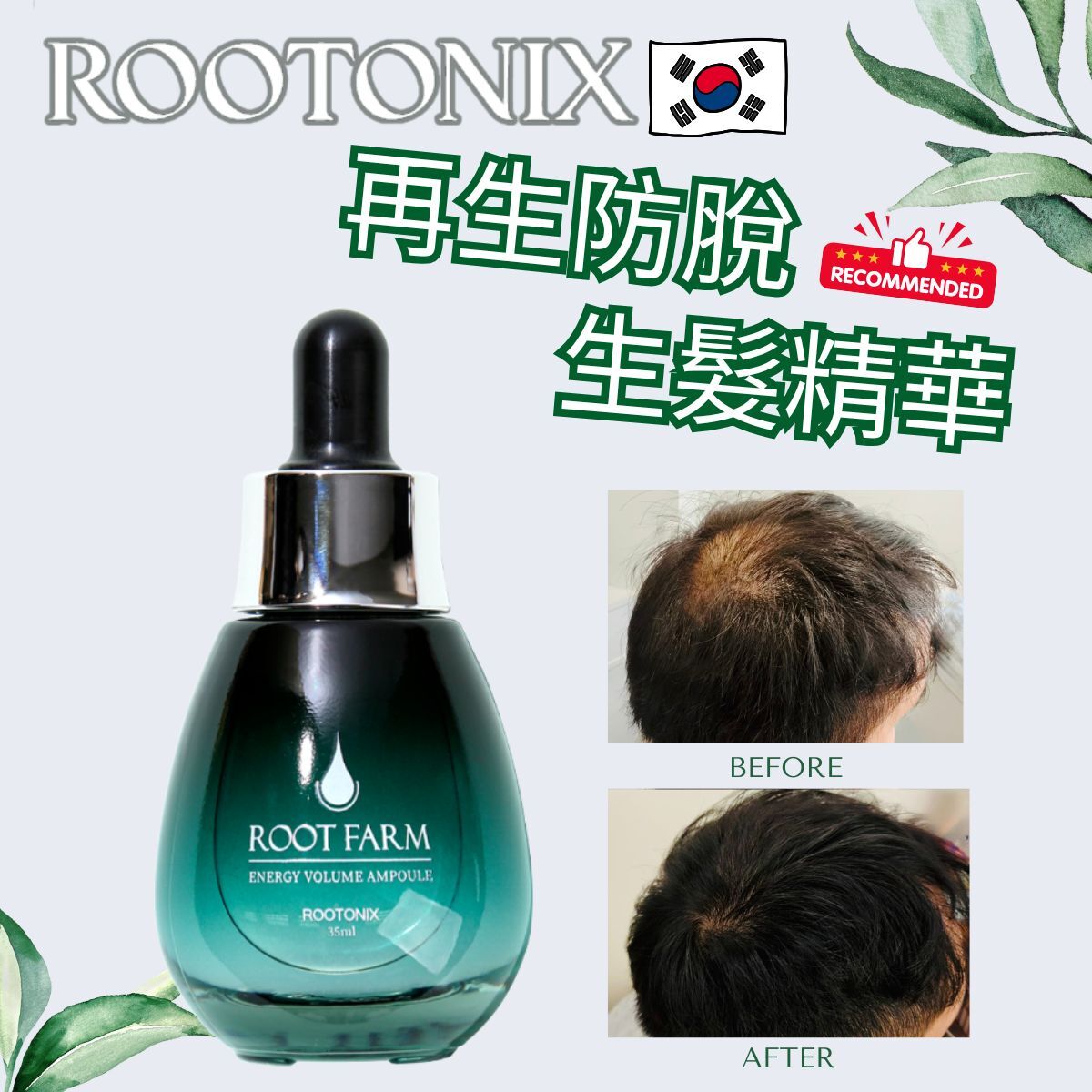 韓國Rootonix  生髮精華 脫髮救星ROOT FARM 35ml[香港代理]