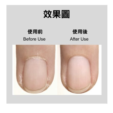 baby:nail ︳Cuticle Remover