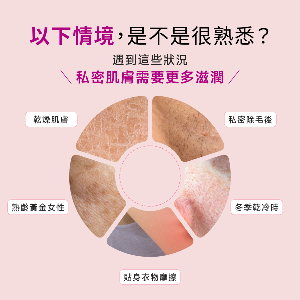 密除毛後、冬季乾冷時、乾燥肌膚族群、熟齡黃金女性、貼身衣物摩擦,遇到這些狀況肌膚需要更多的滋潤調理