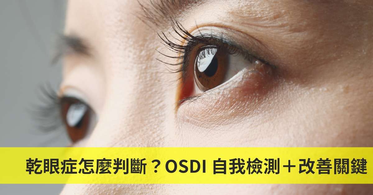 乾眼量表 OSDI