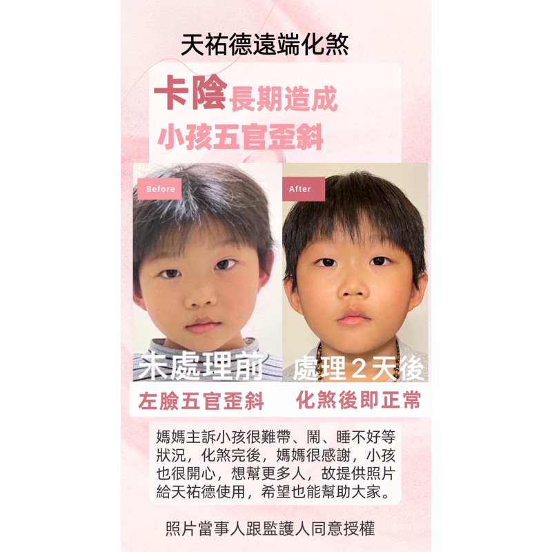 《天祐德》ㄧ代強力解煞‼️解靈異干擾量子雙面撓場項鍊