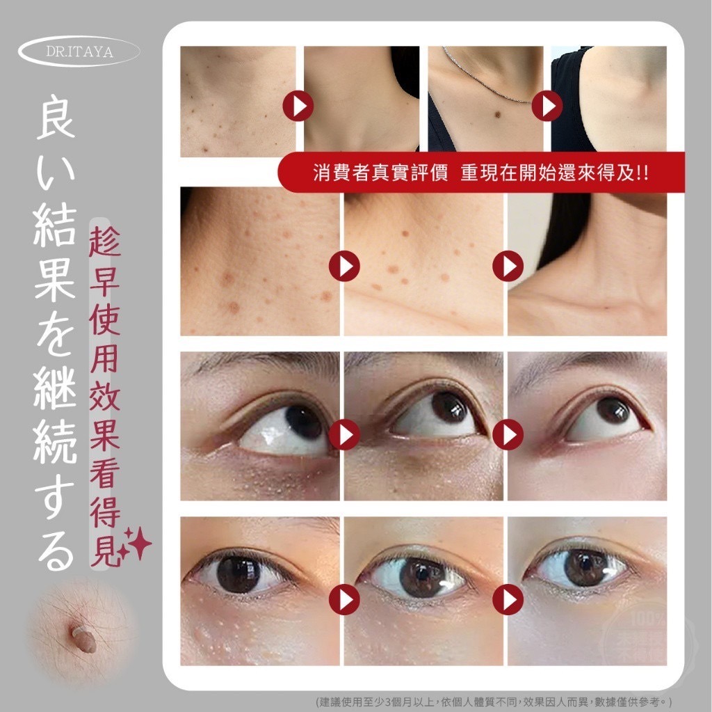 DR.ITAYA®️肉芽專科美容EX精華液30ml