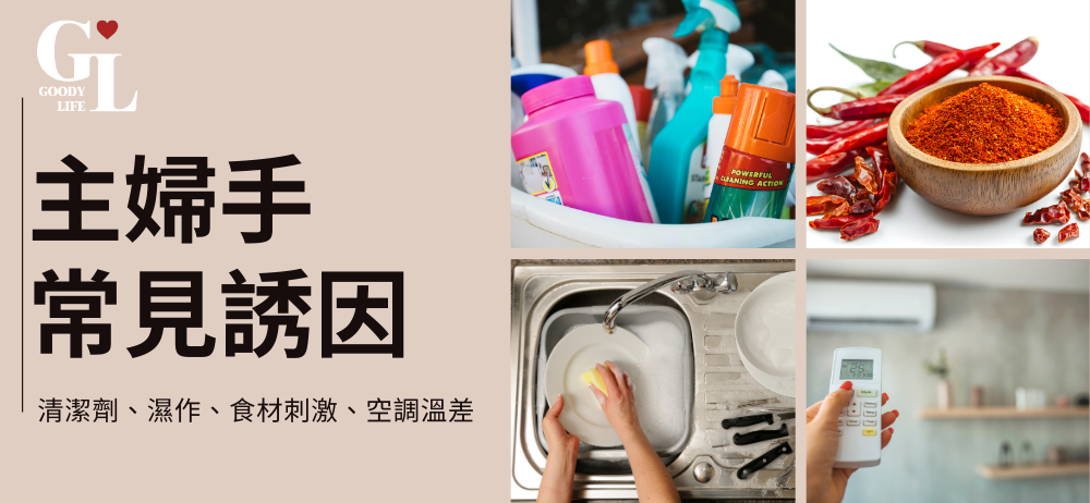 主婦手特徵有哪些？不只是乾燥咁簡單