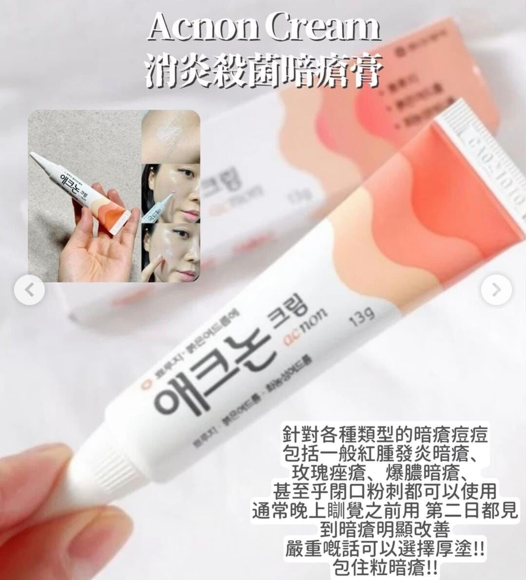 東亞製藥 - Acnon 消炎殺菌暗瘡膏 13g