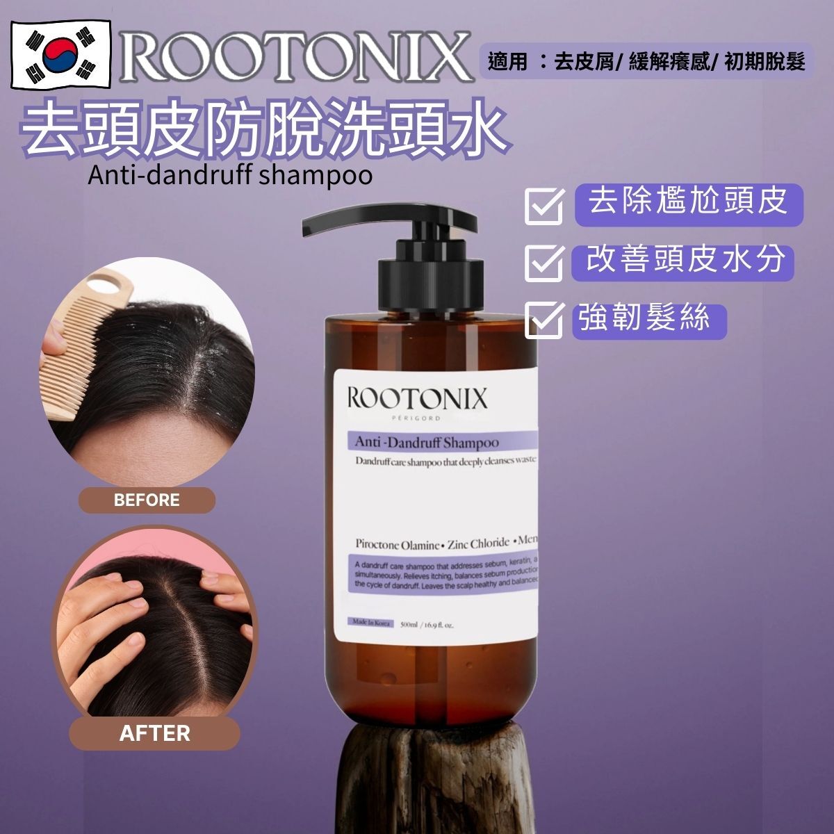 韓國 ROOTONIX 去頭皮防脫洗頭水 Anti-dandruff shampoo 500ml