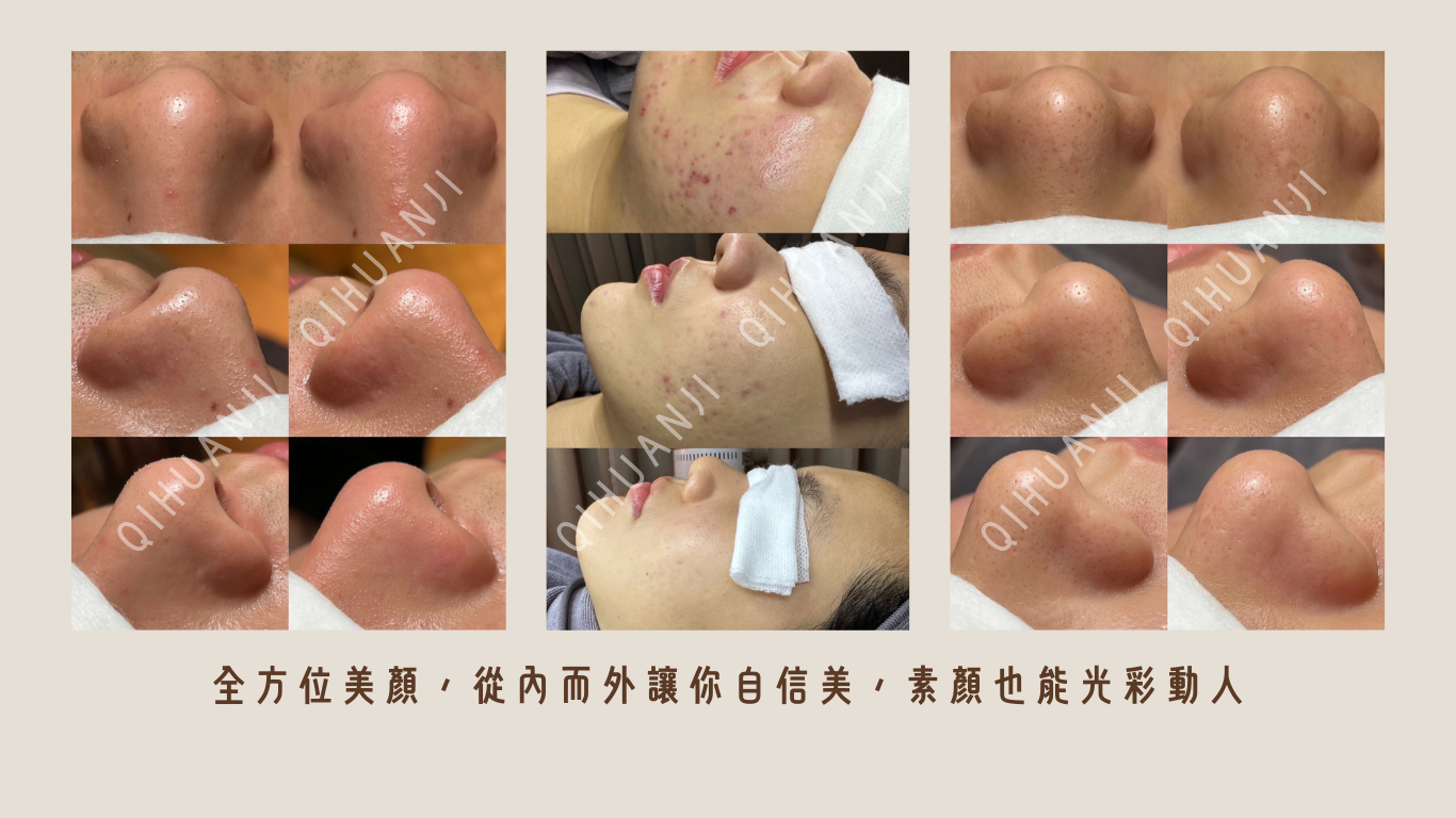 奇煥肌美學概念館、台北做臉推薦、台北清粉刺推薦、水飛梭台北推薦、台北痘痘調理、敏感肌做臉推薦、大橋頭做臉、台北指壓按摩、台北睫毛管理、台北美甲推薦