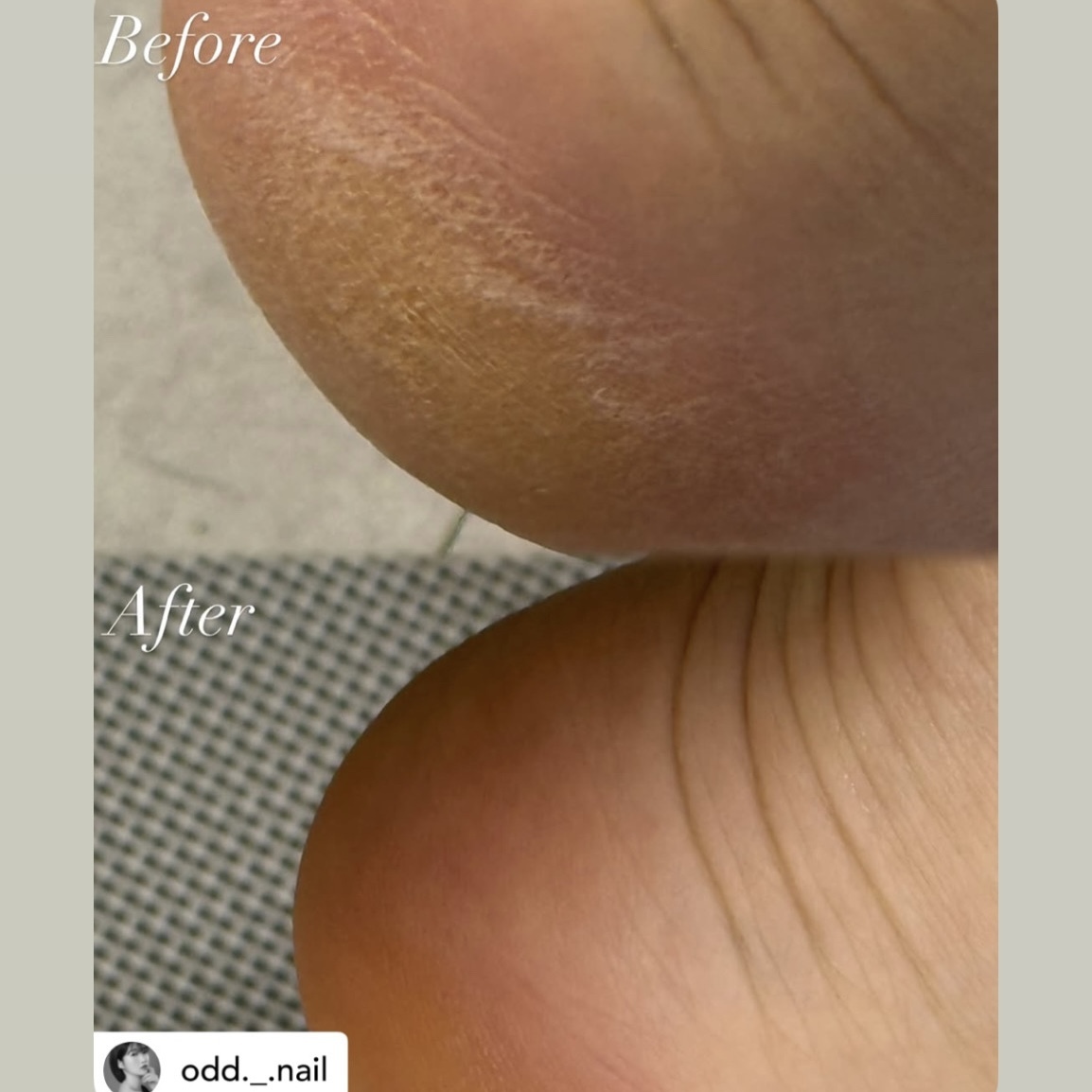 拯救乾裂腳仔精華+Foot Balm