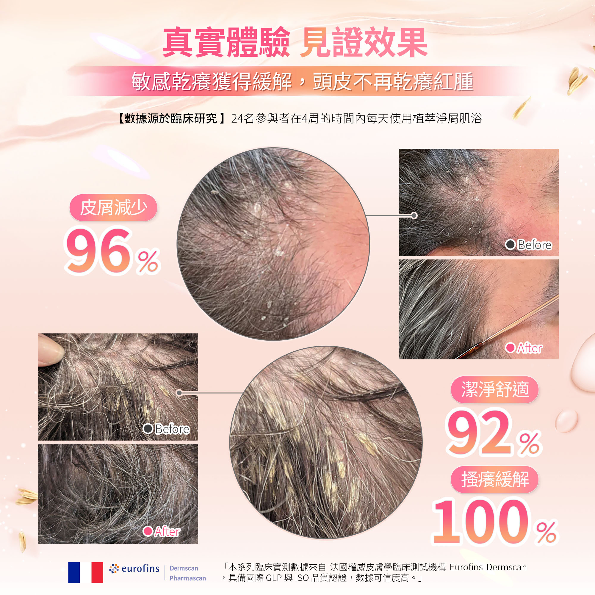 植萃淨屑肌浴,髮妝之鑰,法國LB