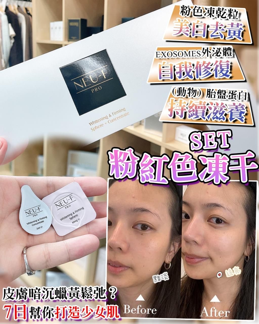 Neu-F Whitening/Firming Sphere+Concentrate 粉紅色凍干set