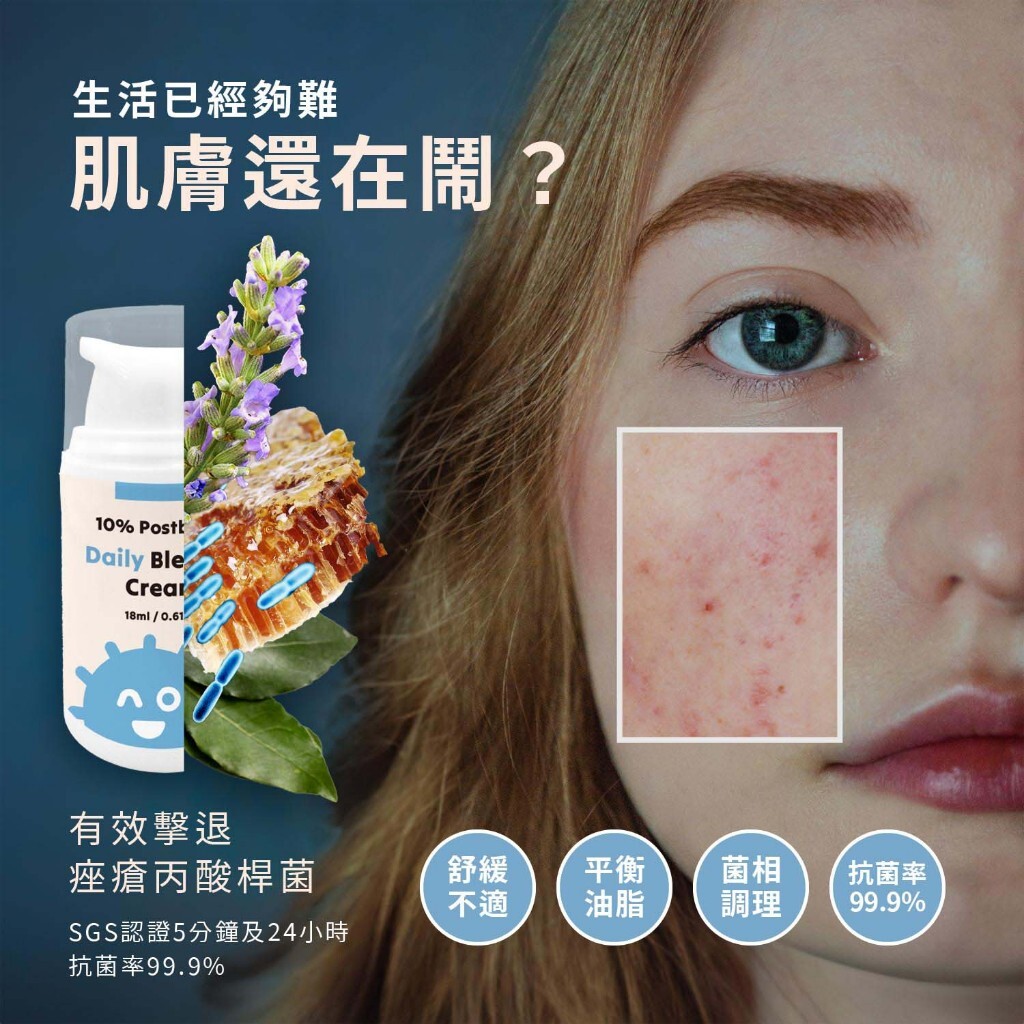 【樂森藥局】ELLO 益生菌粉刺掰掰霜 Daily Blemish Cream 18ML