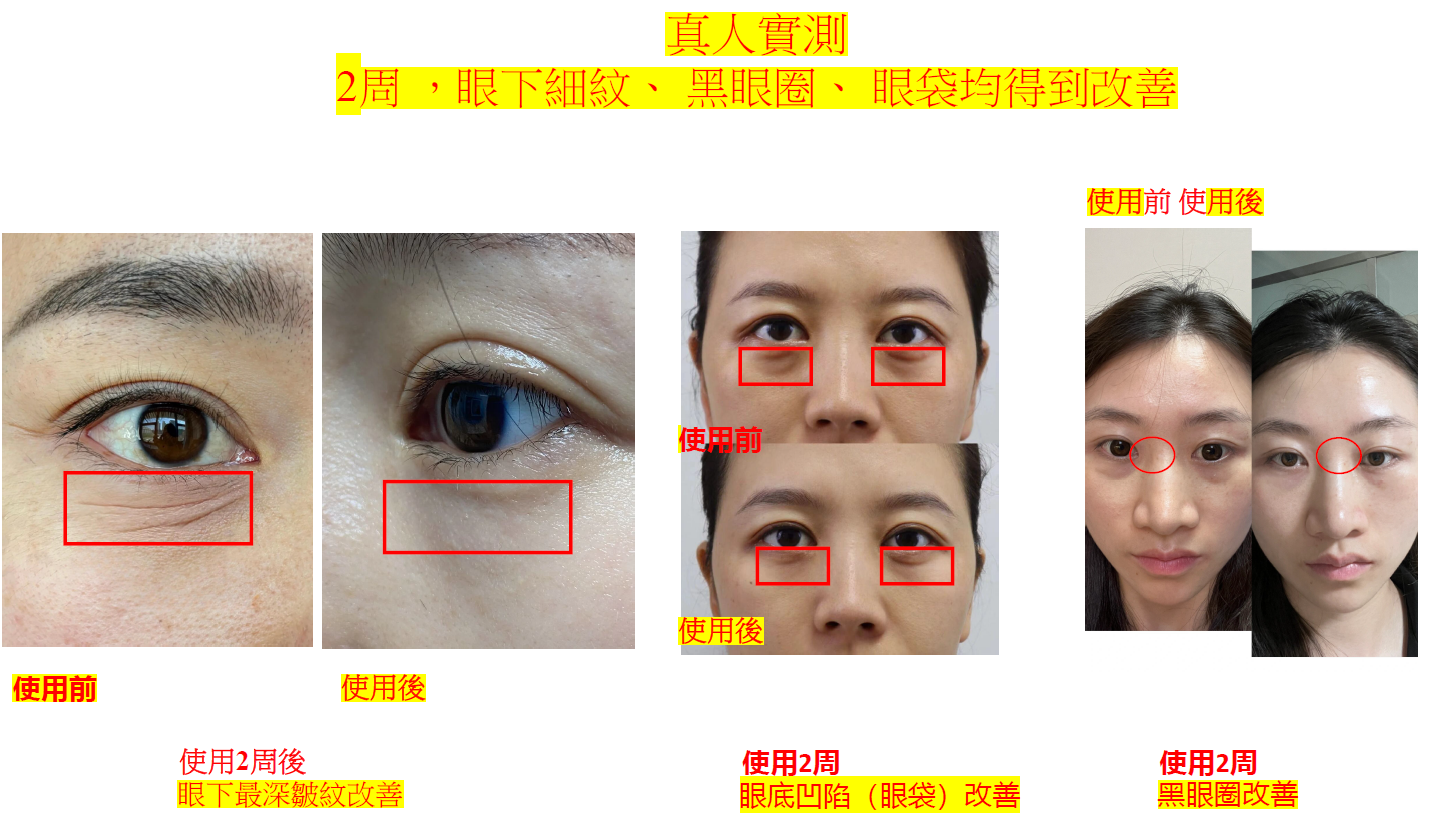 UT94 韓國🇰🇷 Orgahue人魚熱瑪吉抗皺眼膜10ml $399 made in korea