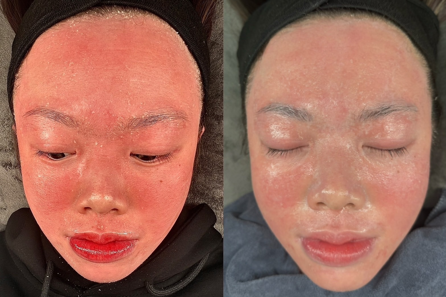 2026限時優惠 泌美麗獨家優惠方案