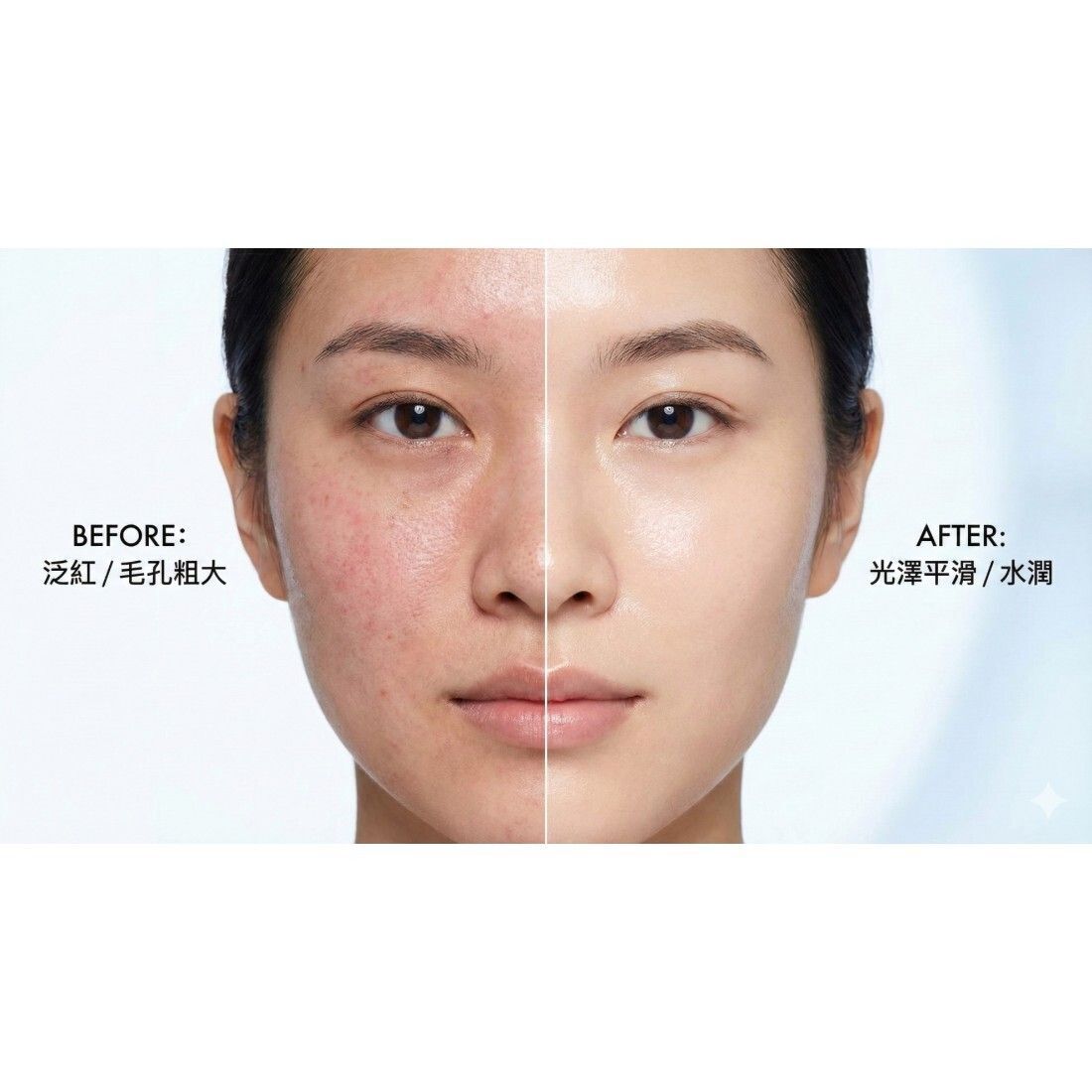 韓國MSOP 救命水4.0 消炎版30ml 【買一送一優惠】