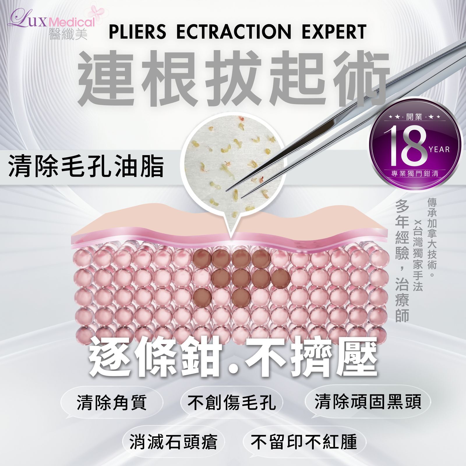 皇牌無痛獨家鉗清❇️再送水注導入 [#bt007]