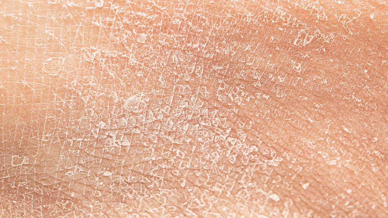 維生素B5可以解決肌膚抓不住水的困擾