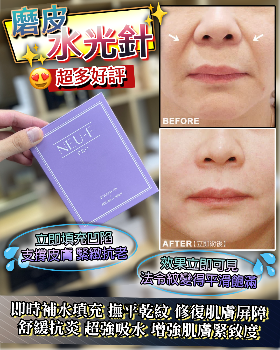 Neu-F Pro Jevenate Ha + Solaris Peptide（買一送一，共兩盒）