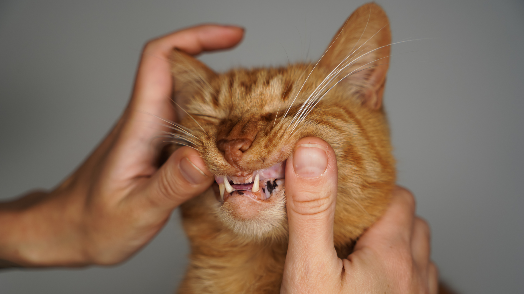 牙科治療費用通常較高，因為它包含的不僅是「洗牙」本身，還涉及多項專業技術和資源。