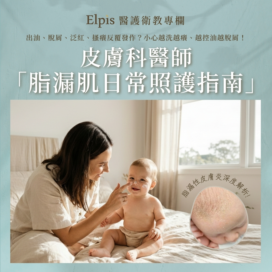 脂漏肌日常照護指南