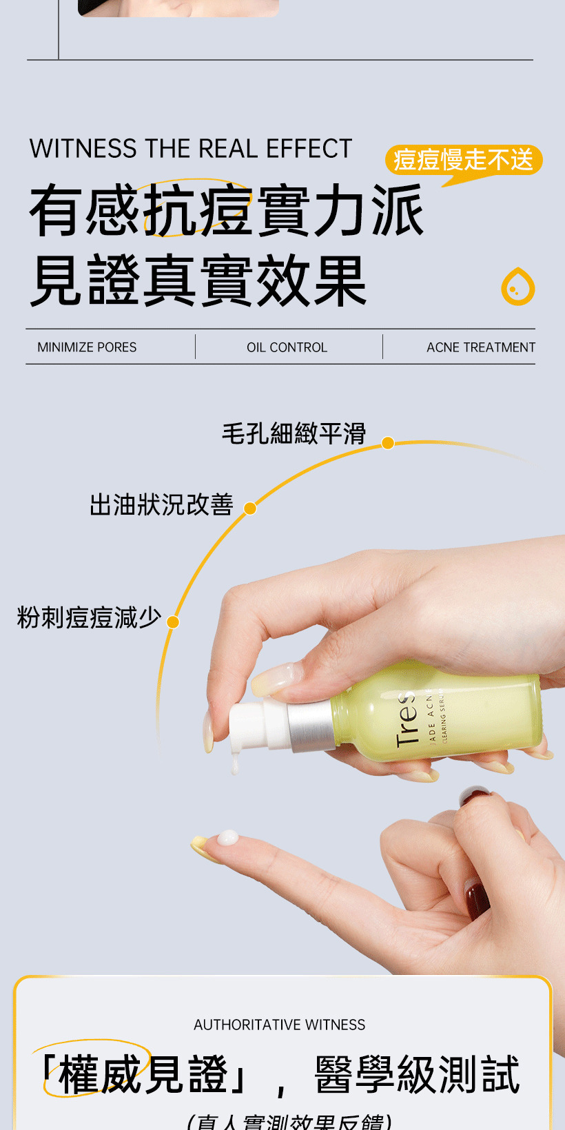 抗痘精華液_痘痘精華_控油精華