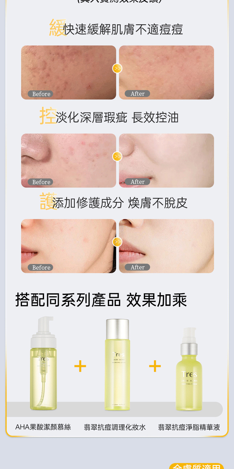 抗痘精華液_痘痘精華_控油精華