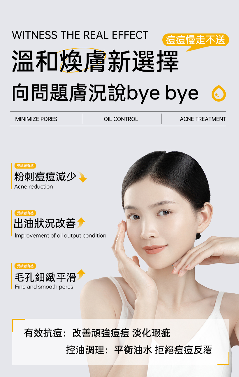 抗痘化妝水_粉刺化妝水_收斂水