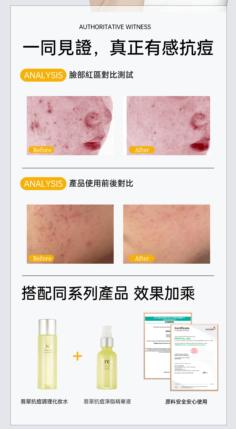 抗痘化妝水_粉刺化妝水_收斂水