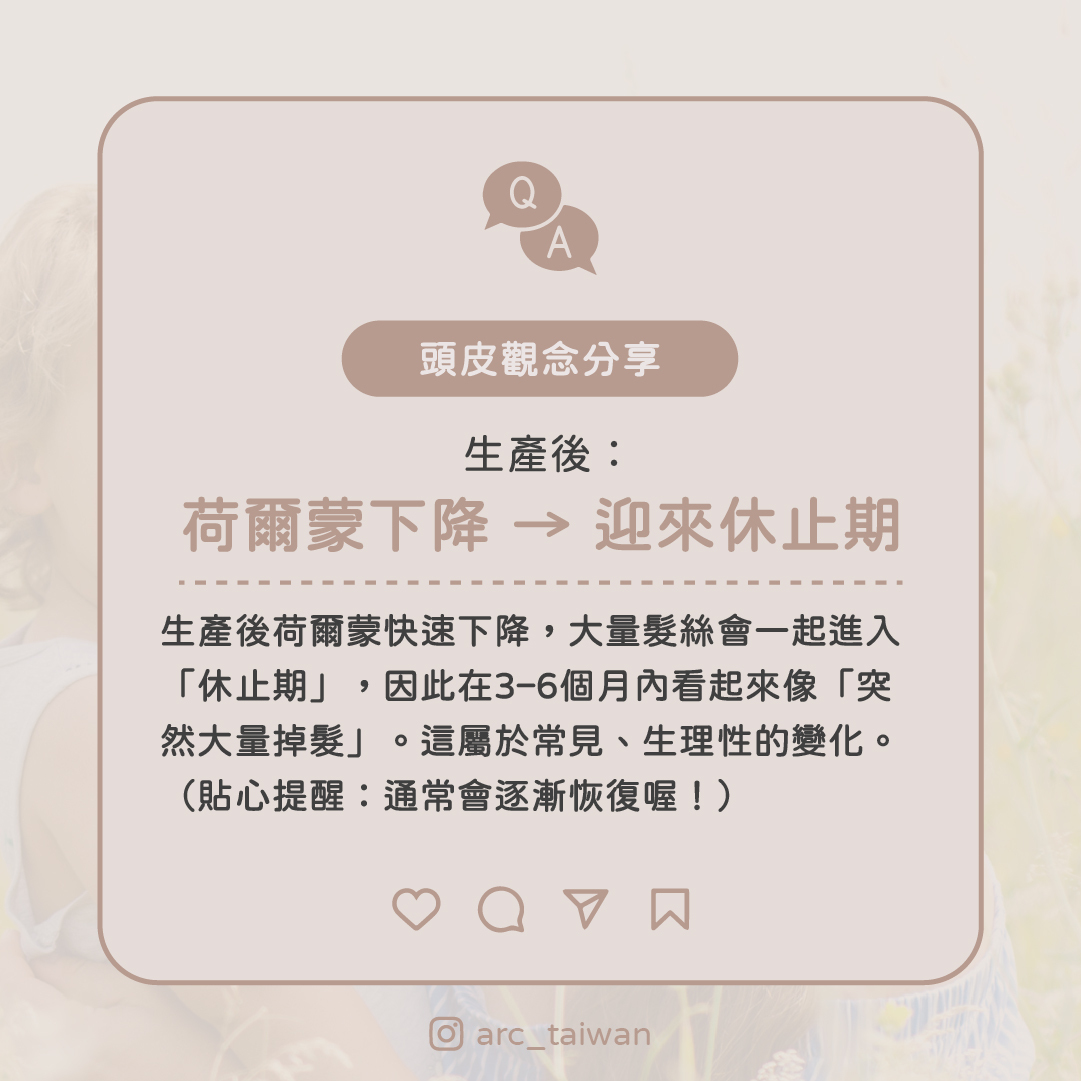 生產後：荷爾蒙下降 → 迎來休止期  生產後荷爾蒙快速下降， 大量髮絲會一起進入「休止期」，因此在 3–6 個月內看起來像「突然大量掉髮」。 這屬於常見、生理性的變化。  （貼心提醒：通常會逐漸恢復喔！）