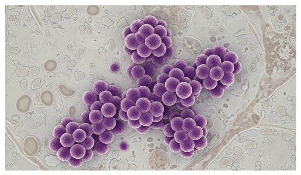 金黃色葡萄球菌是什麼？