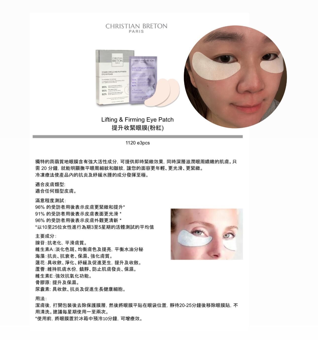 Christian Breton 提升收緊眼膜