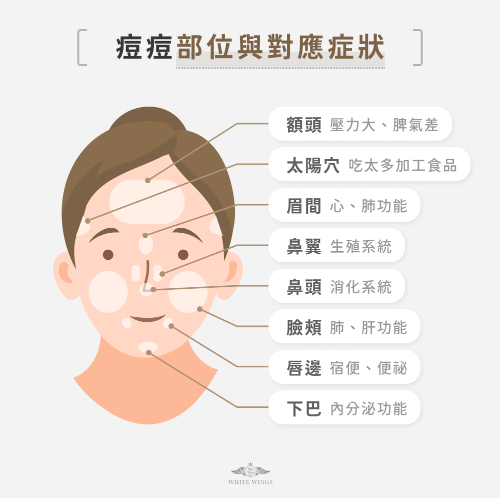 痘痘部位與對應症狀