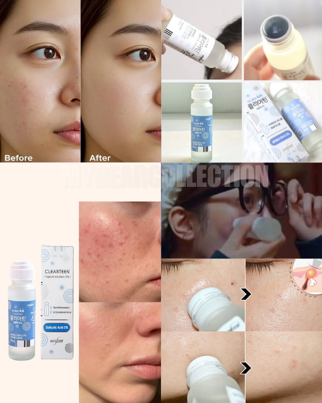 現 貨 l HANDOK Clearteen 韓國國民🥇去痘痘水30ml