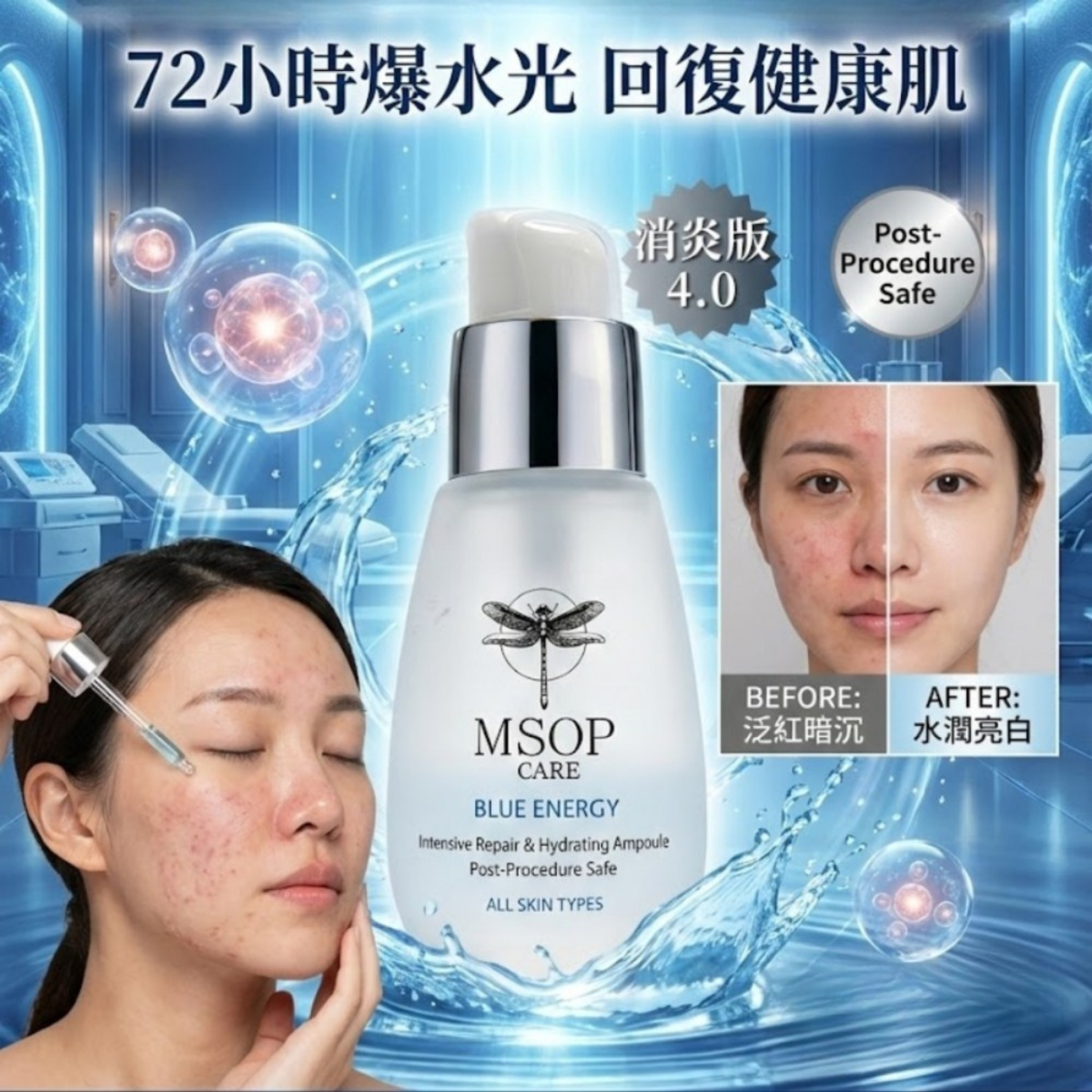 韓國MSOP 救命水4.0 消炎版30ml