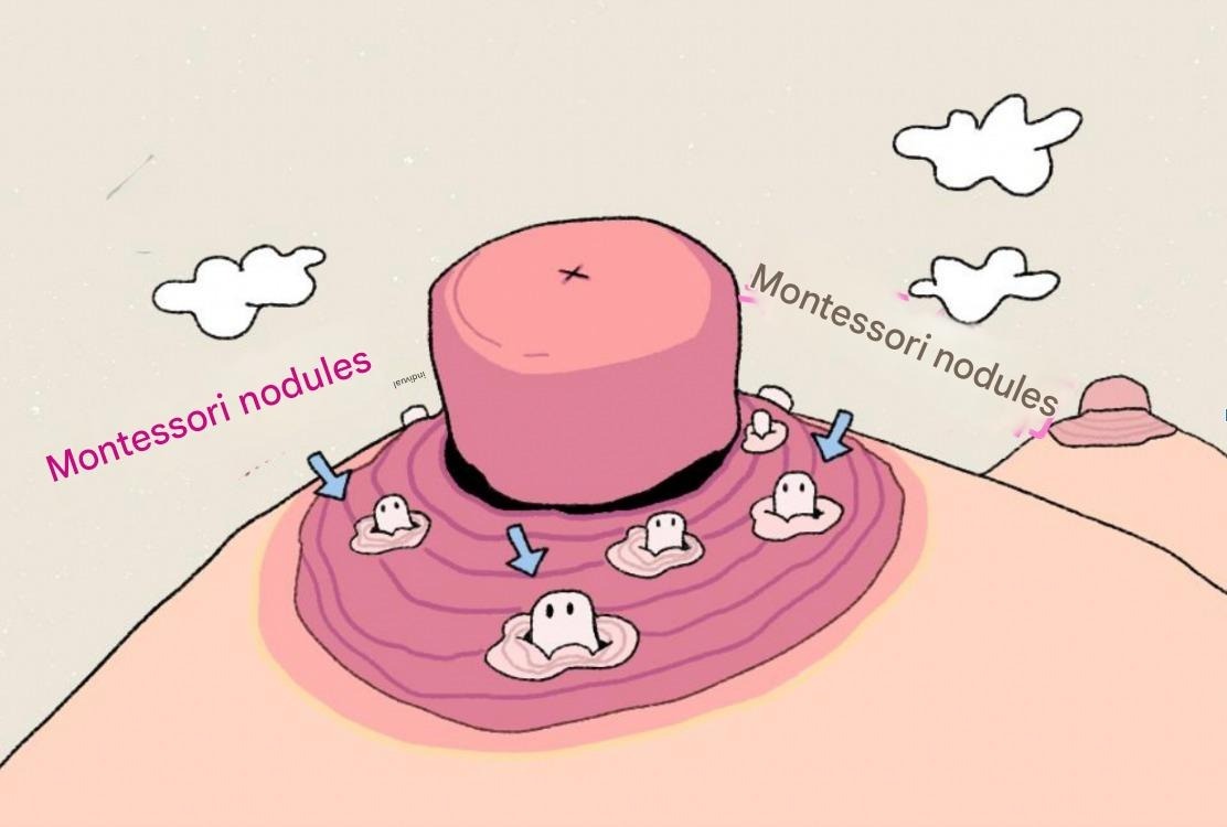 Close-up of Montgomery glands (bumps) on areola