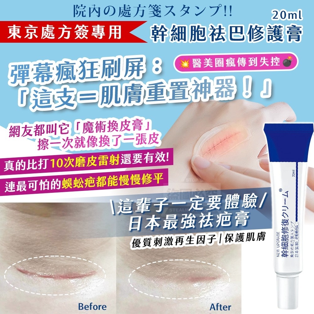 東京處方簽專用幹細胞祛巴修護膏20ml