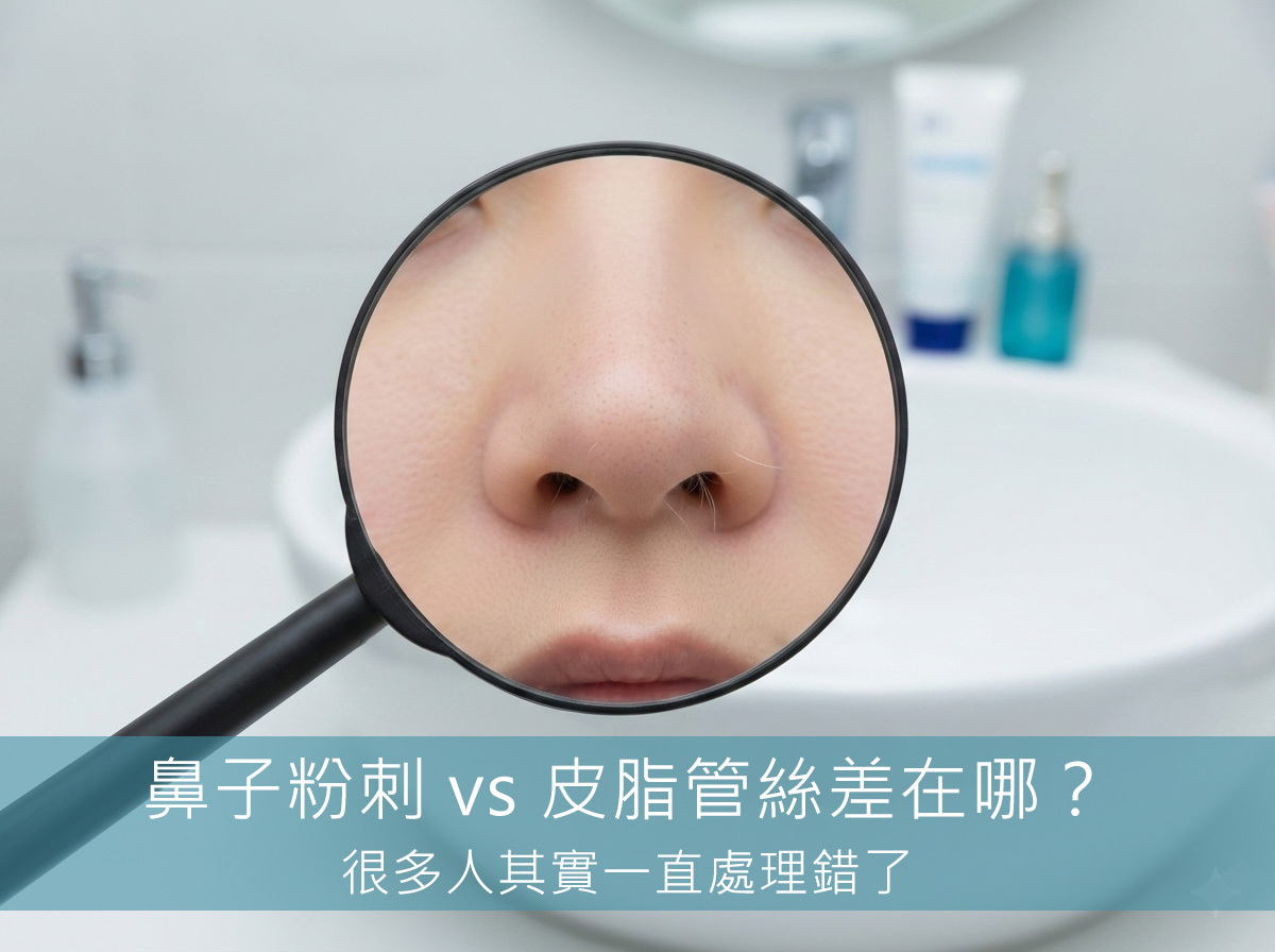鼻子粉刺 vs 皮脂管絲差在哪？很多人其實一直處理錯了