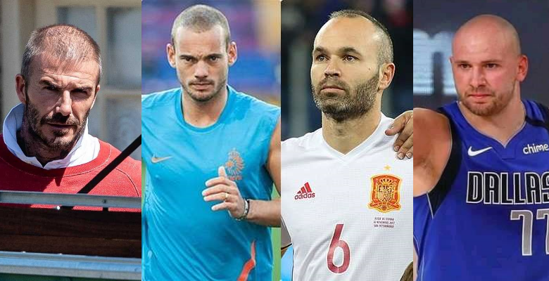 練到爆肌，卻練到禿頭？ LeBron、C羅、貝克漢…連天王級運動員都難逃！