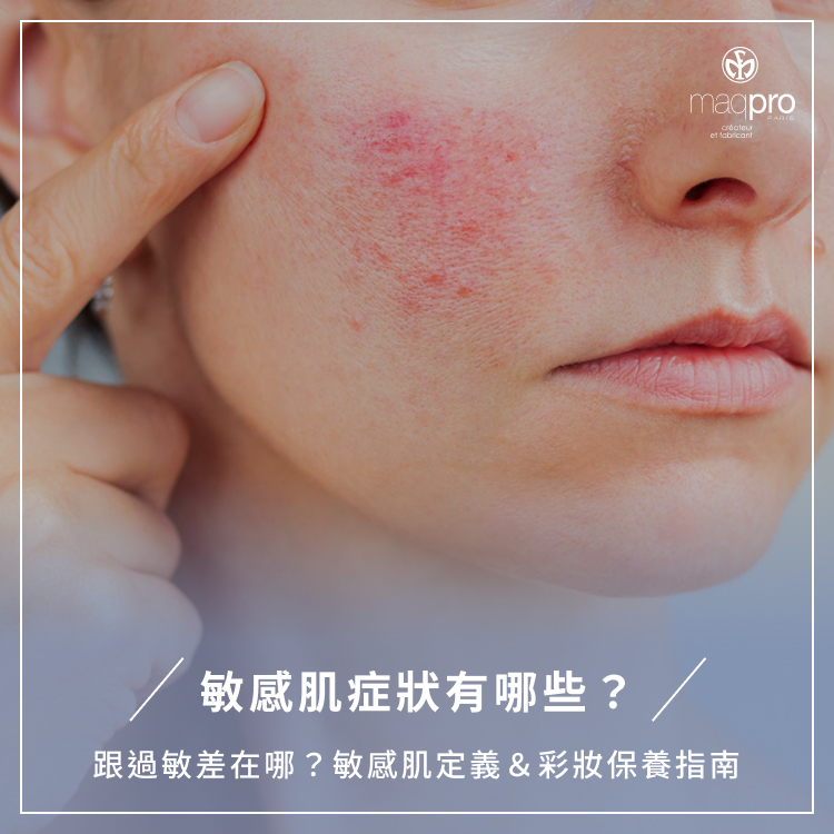 敏感肌症狀有哪些？跟過敏差在哪？敏感肌定義＆彩妝保養指南