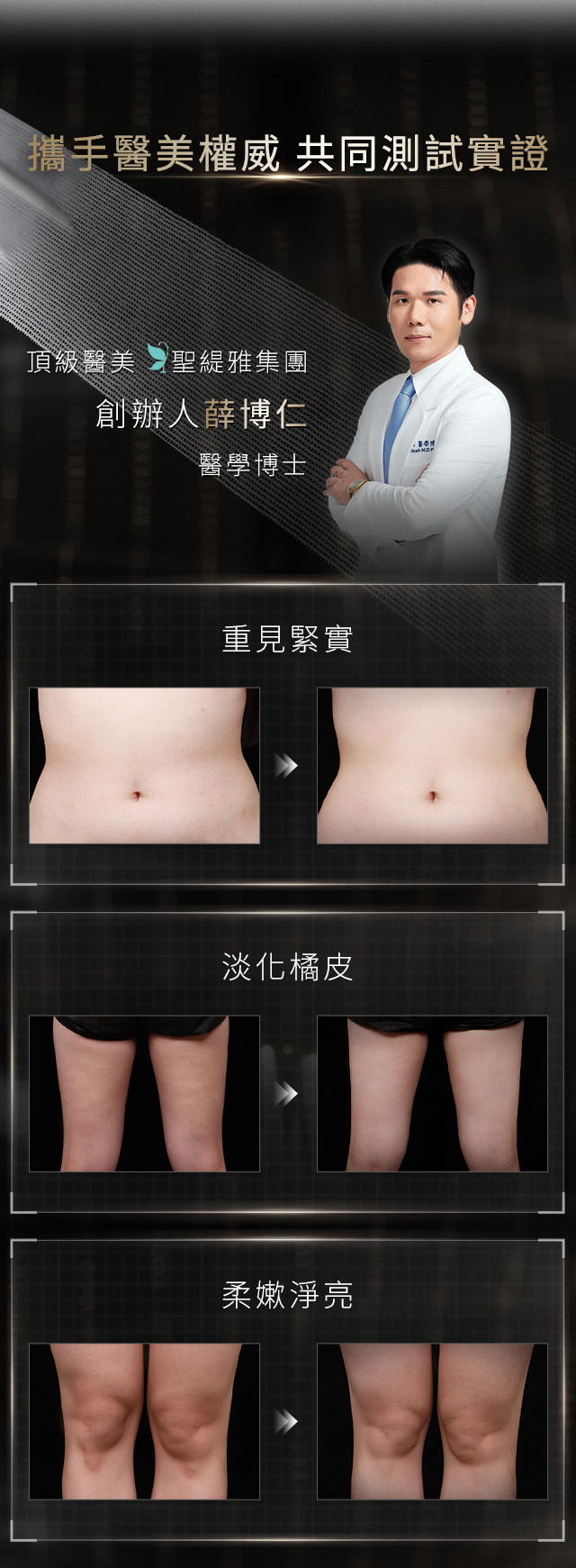 HR黑繃帶系列極塑全效身體霜