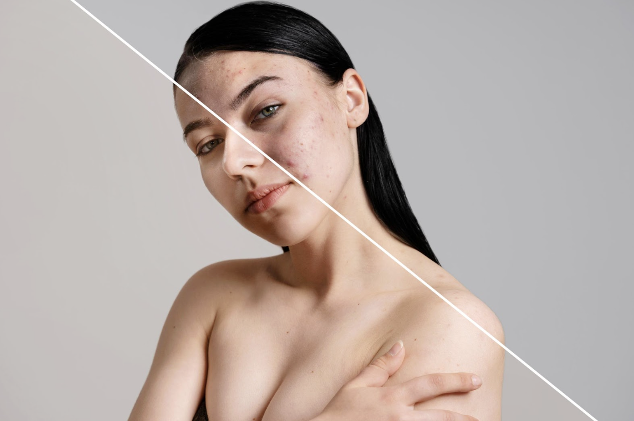 肌膚瑕疵與修復對比