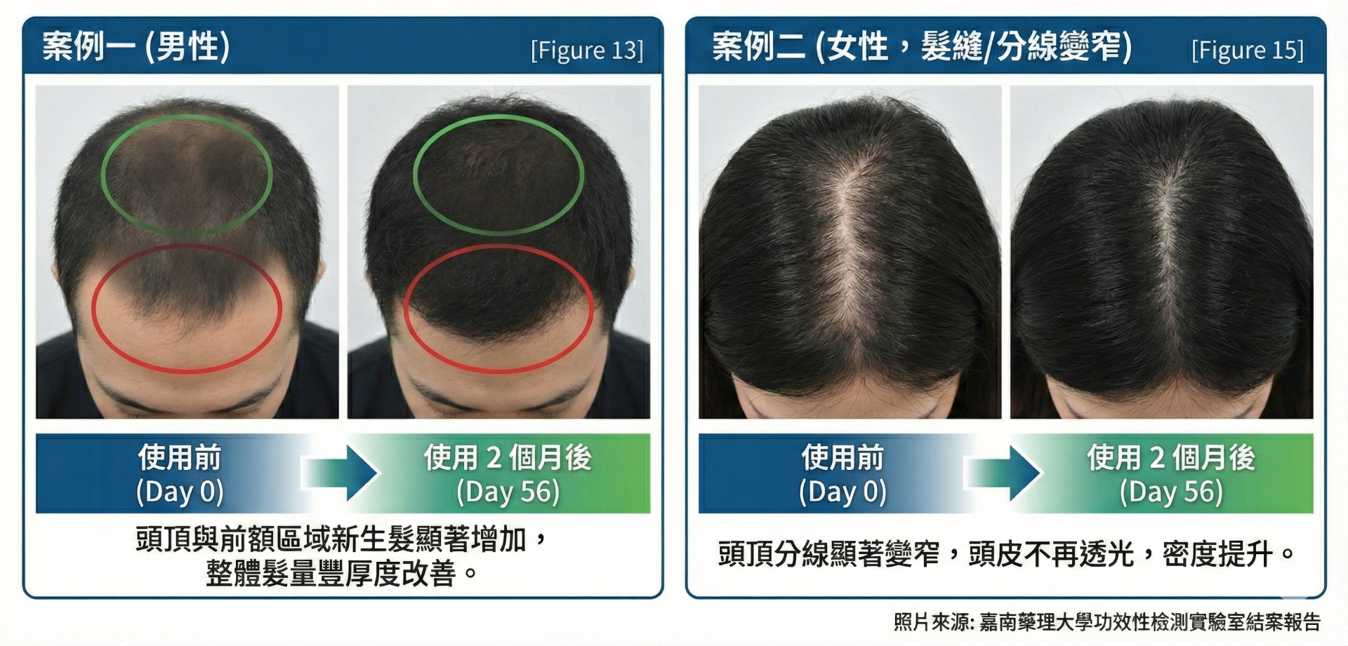 宏觀皮覆蓋率改善