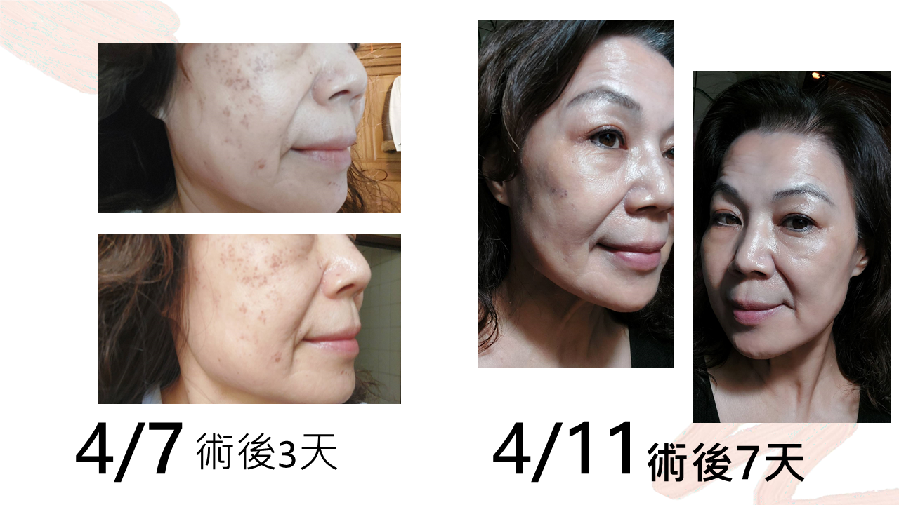 #Jmilagro#臻奇肌#敏弱肌照護專家#臻崴生技#奇肌胜肽#Skin care#奇蹟#科學養膚#肌膚照護#日常保養#同喬