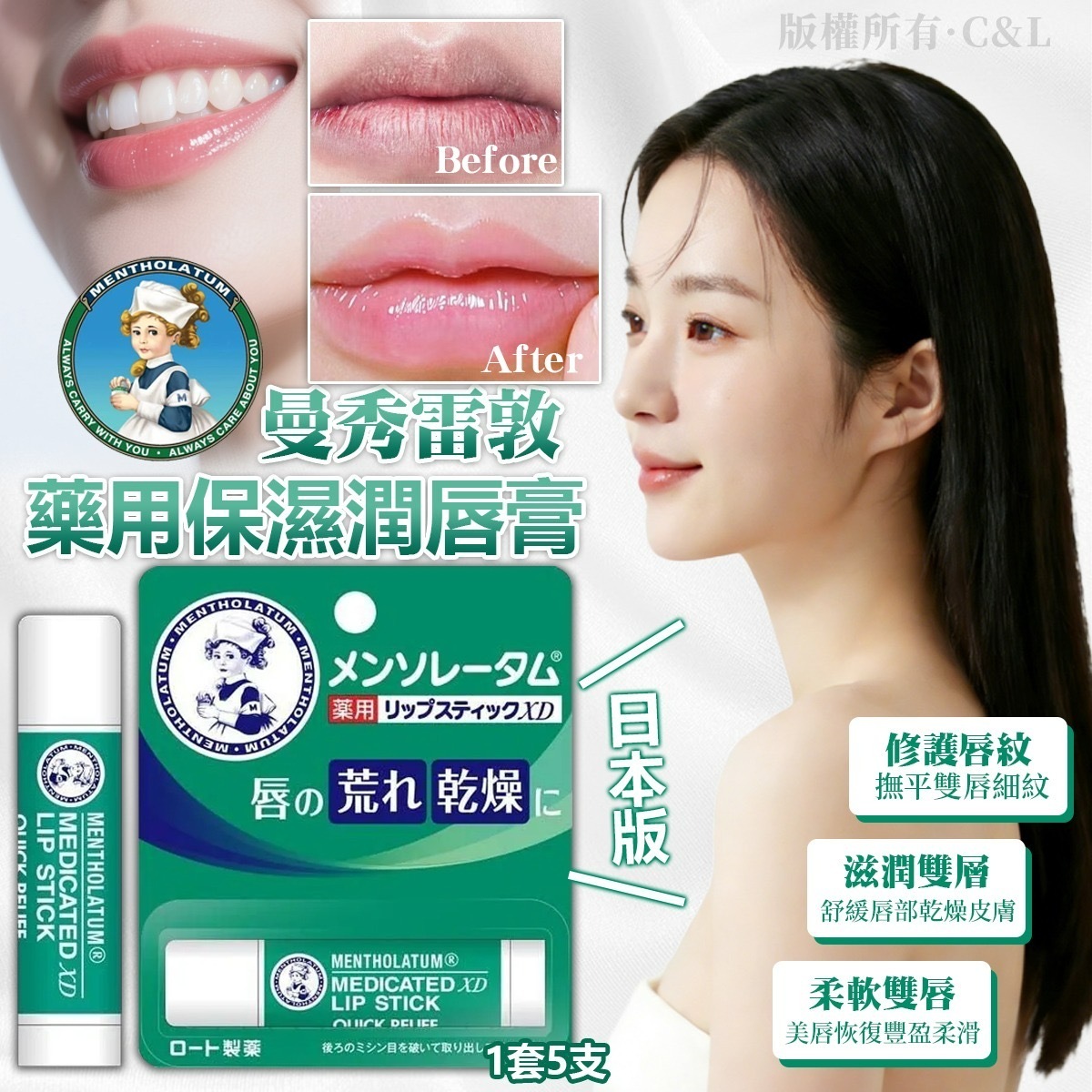 日本版曼秀雷敦藥用保濕潤唇膏4g 1套5支入