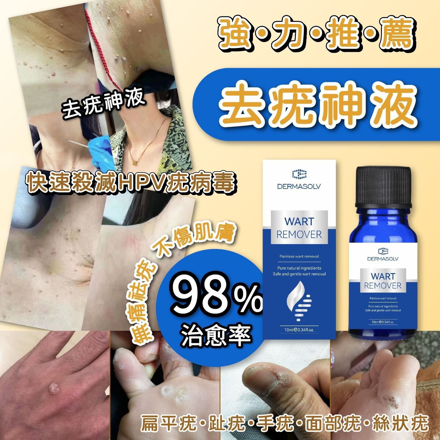 (預訂) DermaSolv強力去疣神液 AT