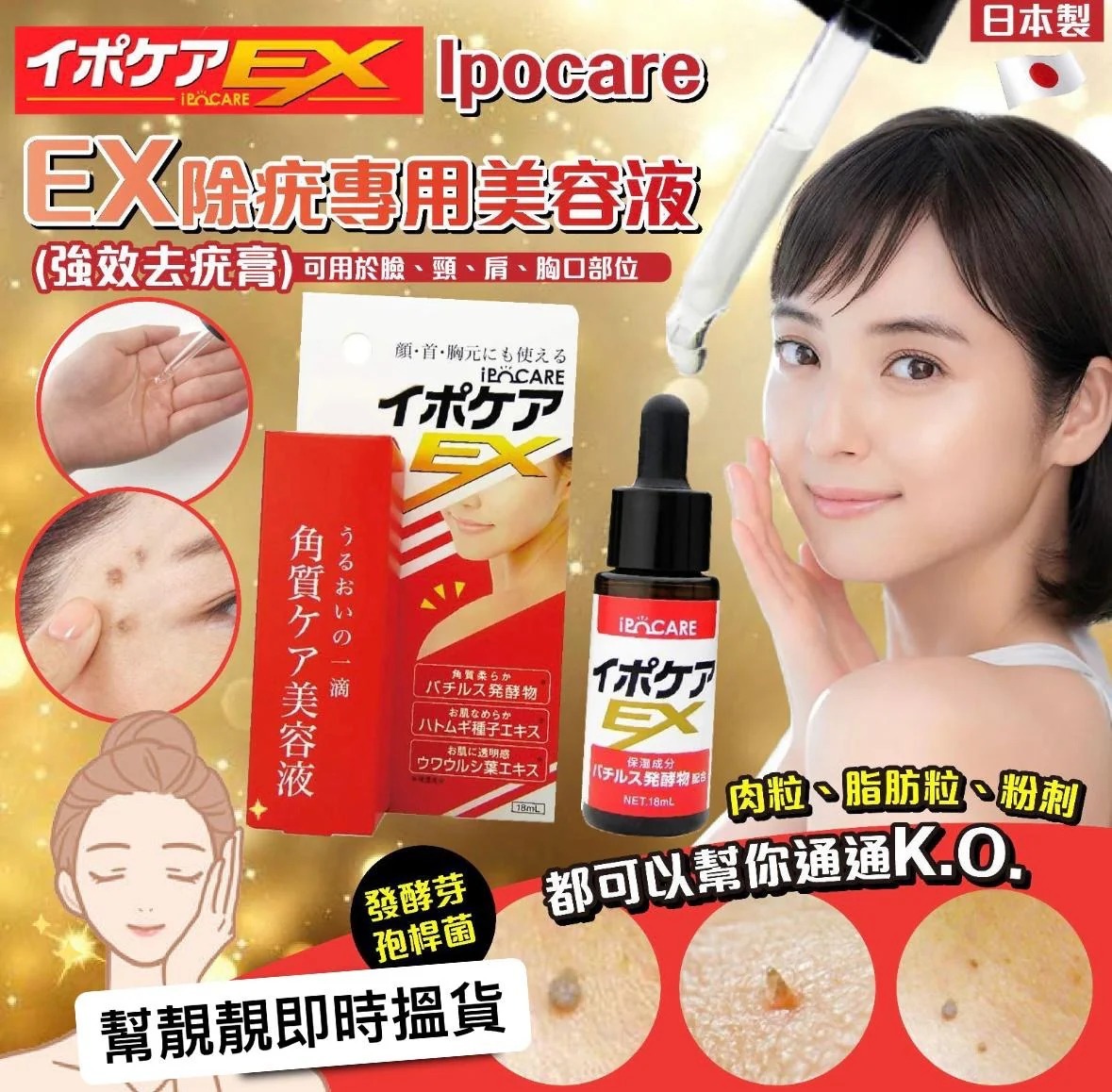 [2FZ1066] (K87) [現貨] ) Ipocare - EX 除疣專用美容液 (強效去疣膏)