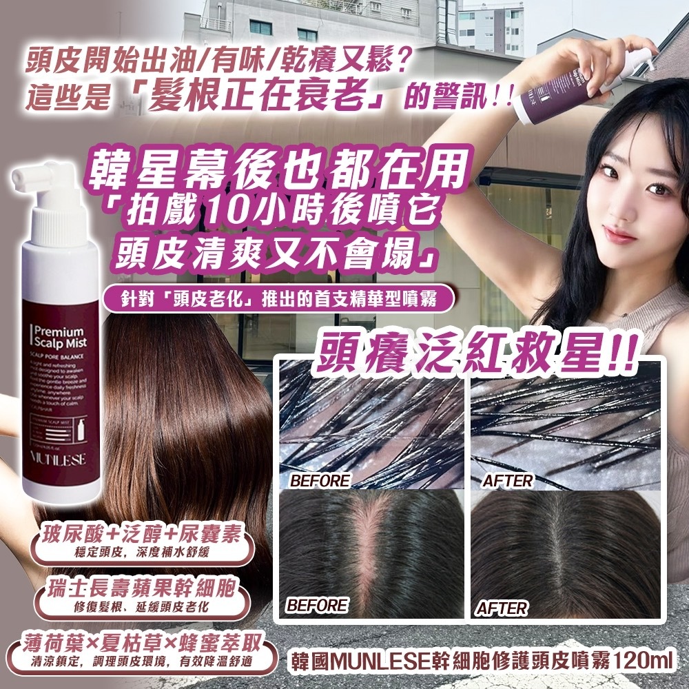 韓國MUNLESE幹細胞修護頭皮噴霧頭皮逆齡從髮根開始120ml
