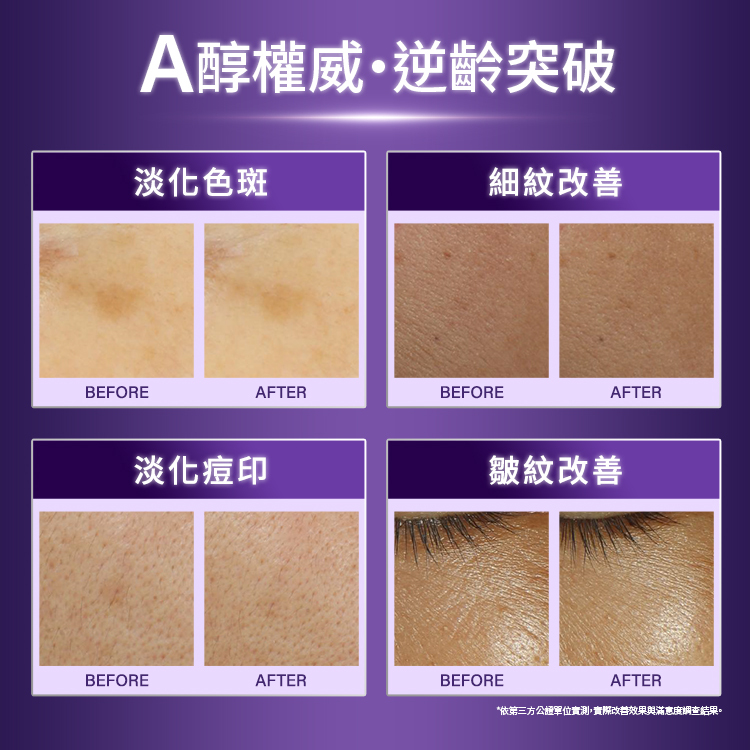 A醇權威、逆齡突破對比。淡化色斑：BEFORE與AFTER對比圖。細紋改善：BEFORE與AFTER對比圖。淡化痘印：BEFORE與AFTER對比圖。皺紋改善：BEFORE與AFTER對比圖。