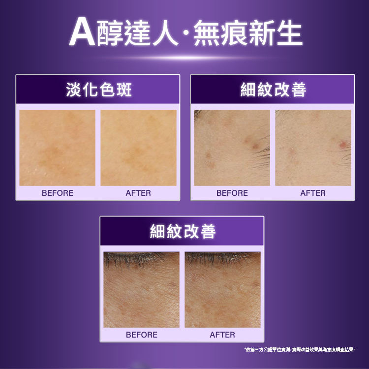 A醇權威、逆齡突破對比。淡化色斑：BEFORE與AFTER對比圖。細紋改善：BEFORE與AFTER對比圖。淡化痘印：BEFORE與AFTER對比圖。皺紋改善：BEFORE與AFTER對比圖。