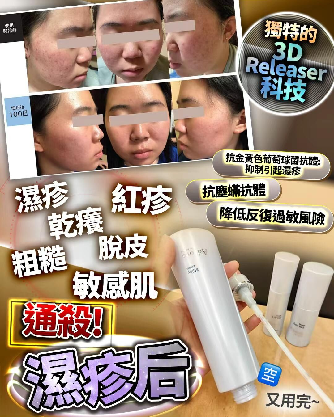 濕疹后 180ml  Z856（2-3星期寄出）