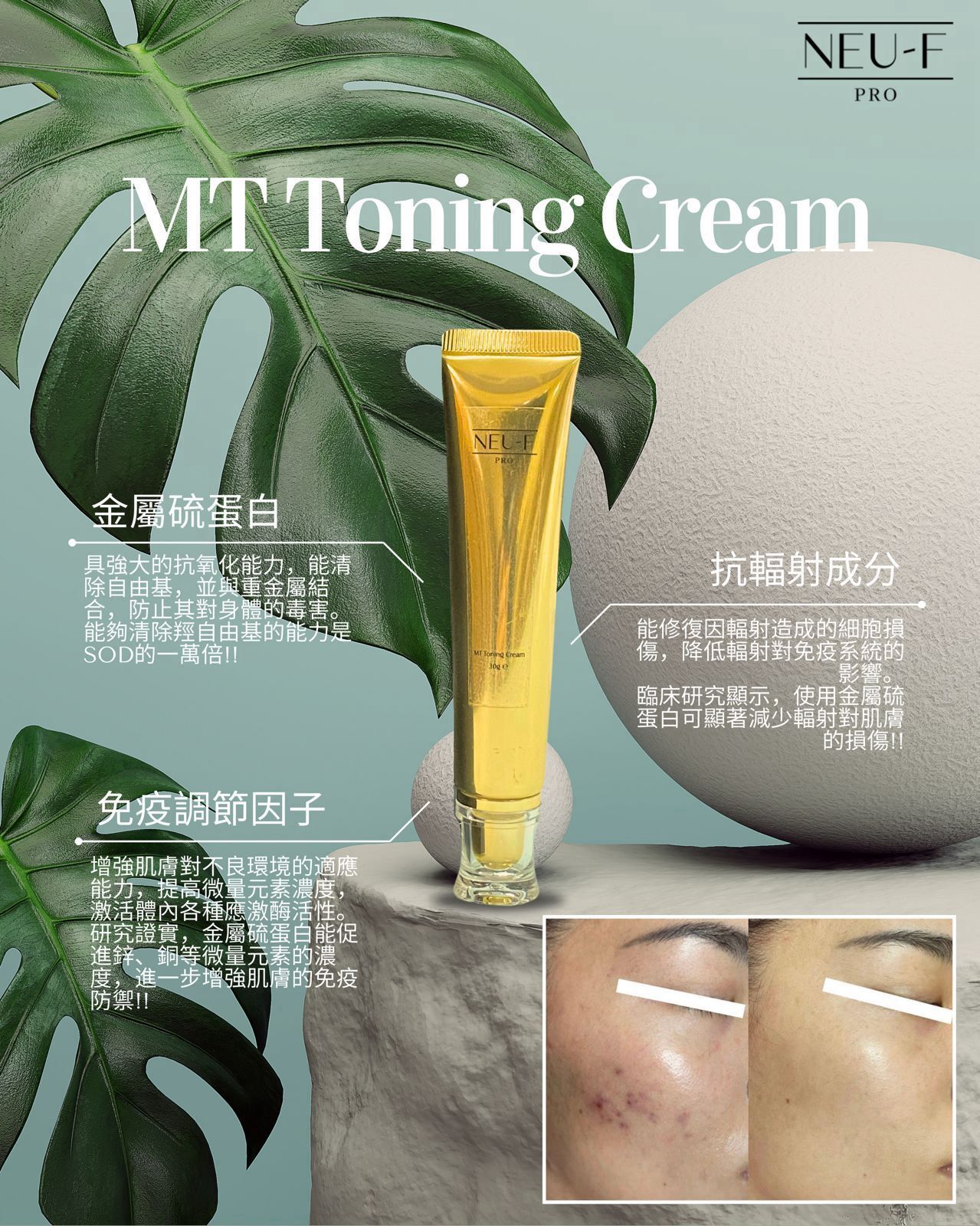 Neu-F Pro MT Toning Cream