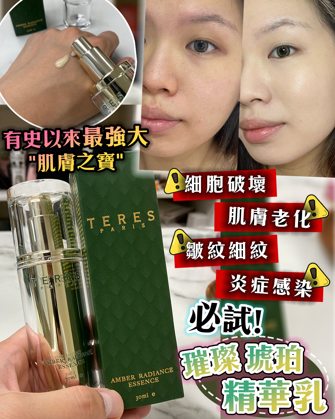 2026護膚開運Party_ TERES Radiant Amber Essence Lotion 璀璨琥珀精華乳 送 Random Mask 2片